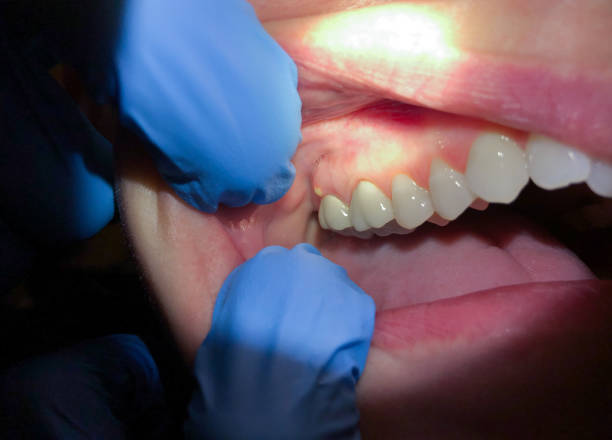 Dentist for Dental Trauma in UT